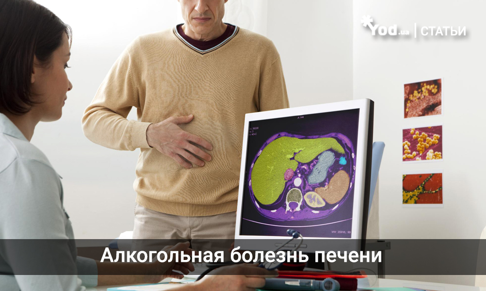 Алкогольная болезнь печени